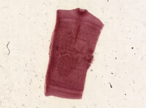 Taenia solium