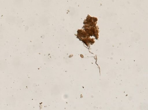 Diphyllobothrium canis
