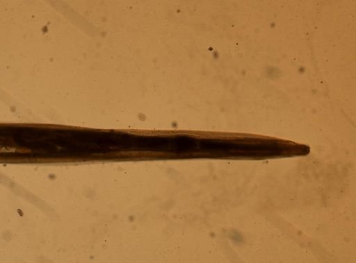 Enterobius vermicularis