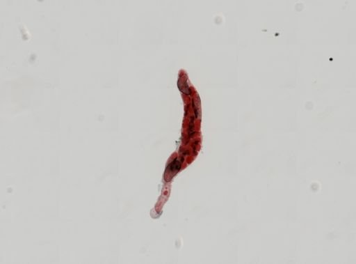 Trematoda