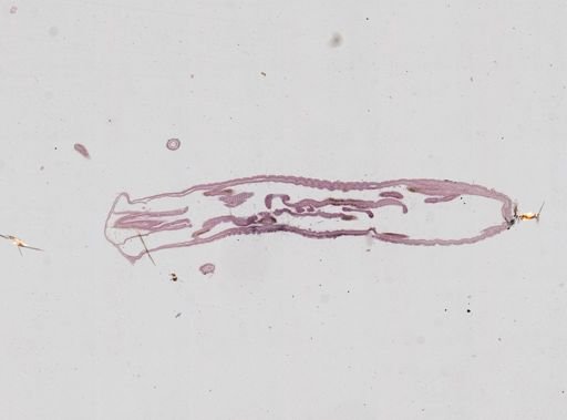Nematostella