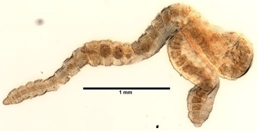 Peosidrilus coeloprostatus