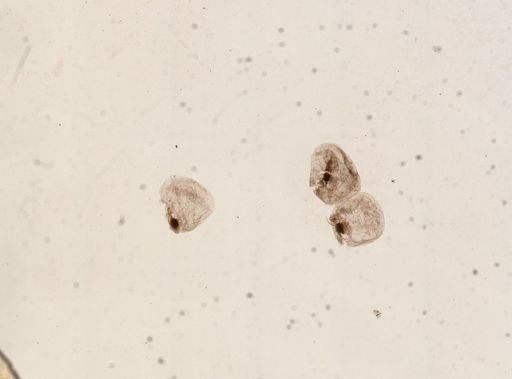 Noctiluca scintillans
