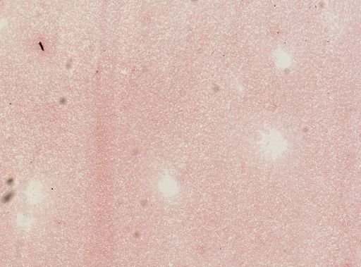 Plasmodium vivax