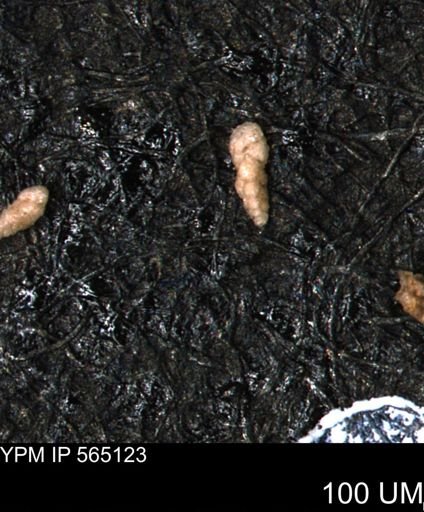 Verneuilina canadensis