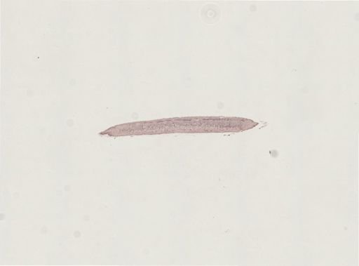 Turbellaria