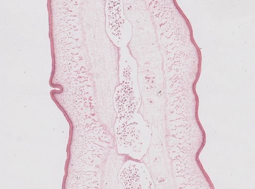 Taenia saginata