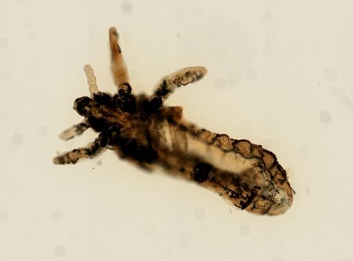 Pediculus humanus