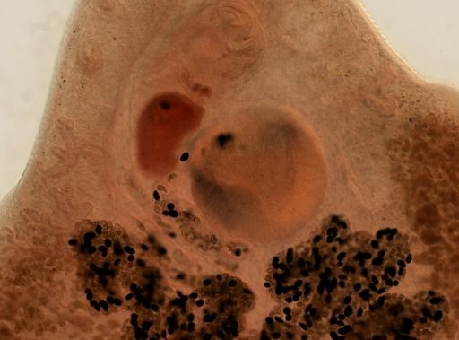 Fasciola hepatica