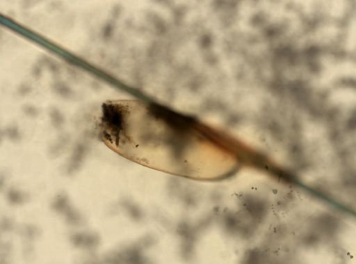Pediculus humanus