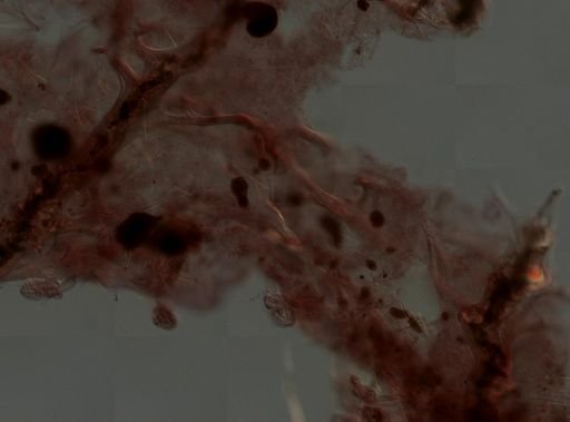 Keratosa