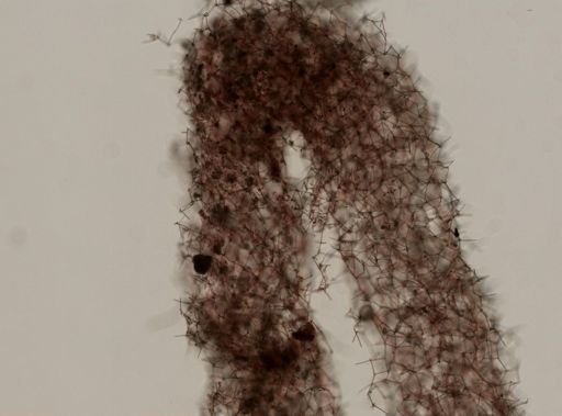 Haliclona