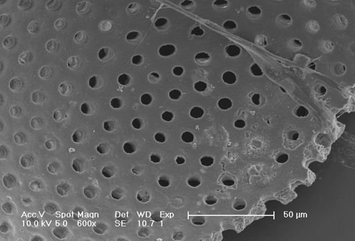 Globigerinoides sacculifer