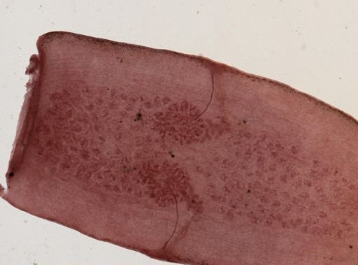 Dipylidium caninum