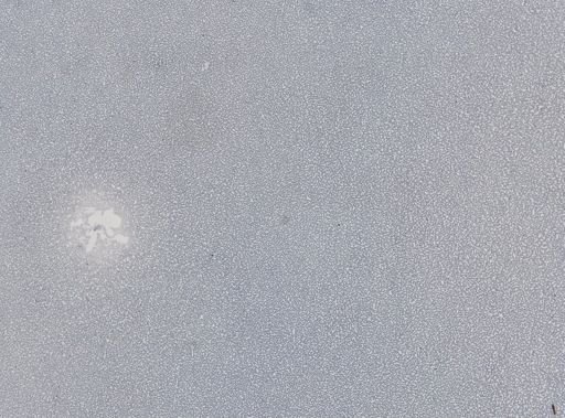 Plasmodium vivax