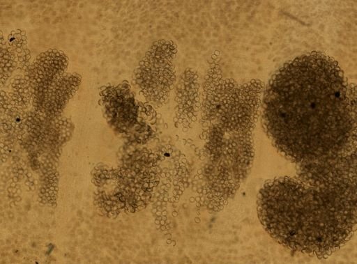 Diphyllobothrium latum