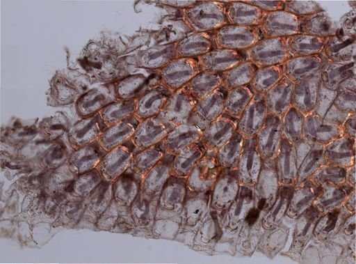 Bryozoa