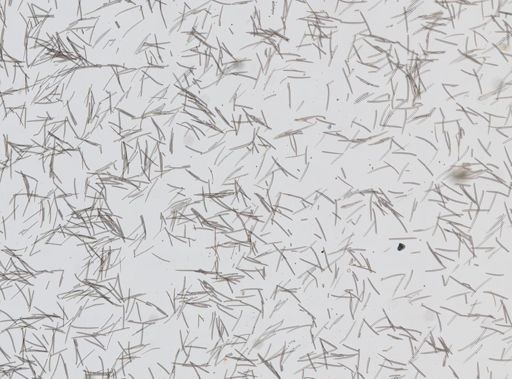 Haliclona oculata