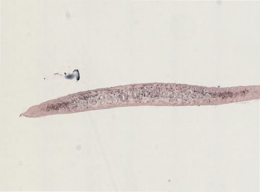 Turbellaria