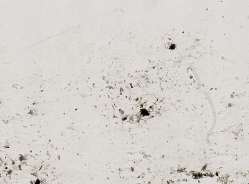 Entamoeba gingivalis