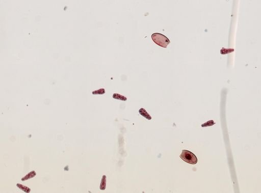 Fasciola hepatica