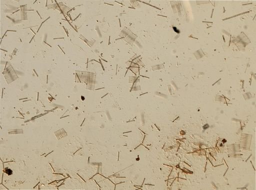 Bacillariophyceae