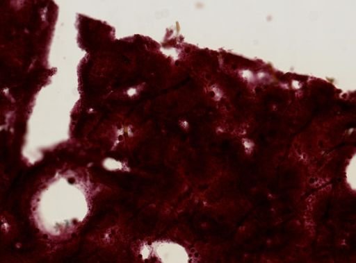 Keratosa