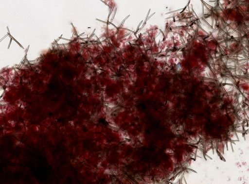 Haliclonidae