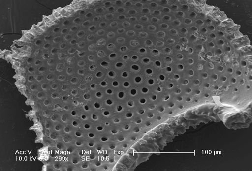 Globigerinoides sacculifer