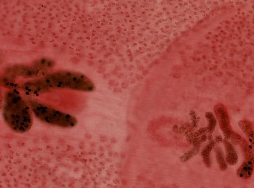 Diphyllobothrium latum