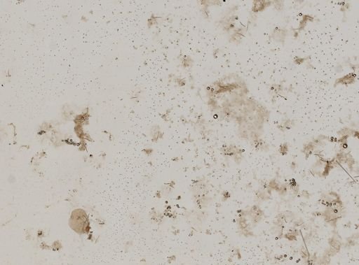 Pione vastifica