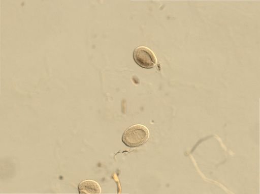 Branchiostoma