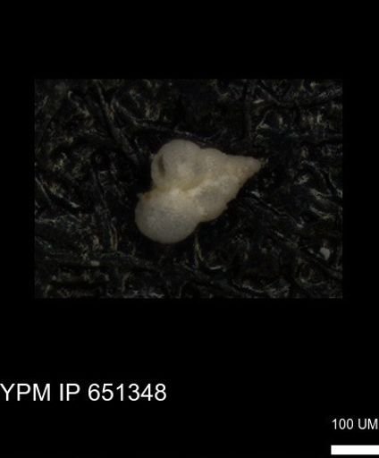 undet. Heterohelicidae