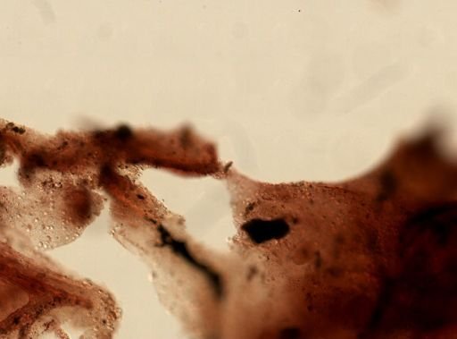 Keratosa