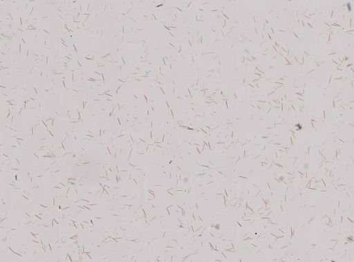 Callyspongia vaginalis