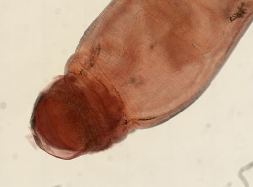 Oligacanthorhynchus microcephalus