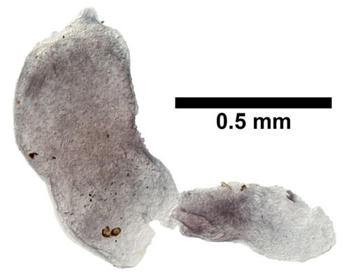 Turbellaria