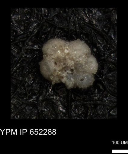 undet. Rugoglobigerinidae