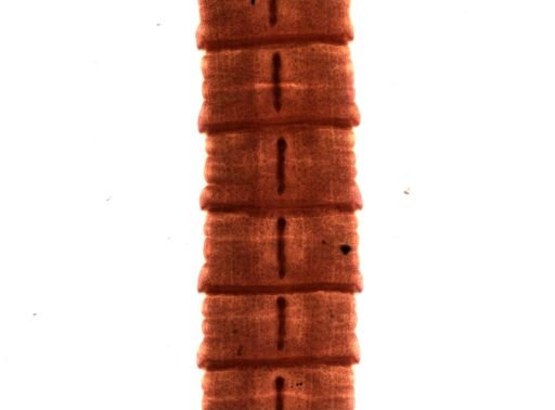 Diphyllobothrium erinacei