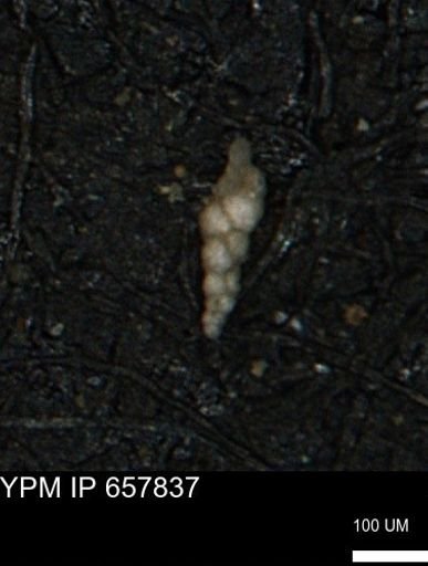 Verneuilinoides kansasensis