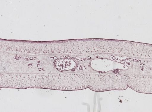 Taenia saginata