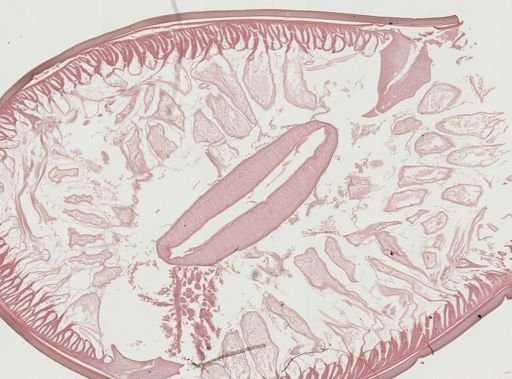 Ascaris lumbricoides