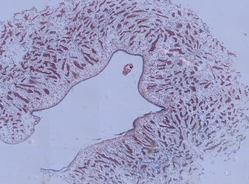 Halisarca sp.