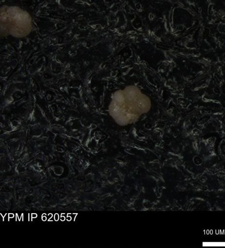 undet. Rugoglobigerinidae
