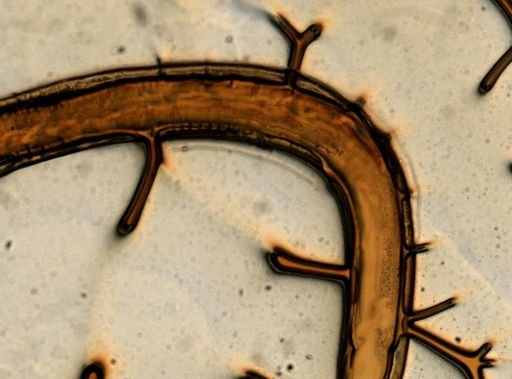 Ancylostoma caninum