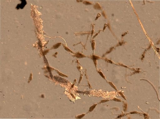 Bryozoa