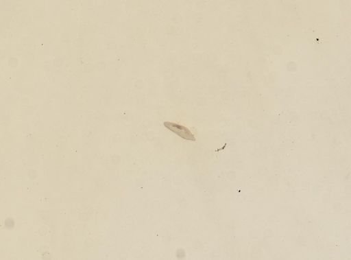 Paramecium multimicronucleatum