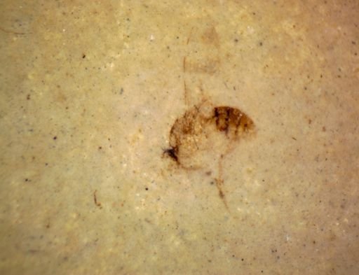 undet. Diptera