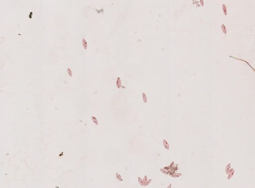 Paramecium