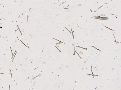 Iophon cf. cheliferum